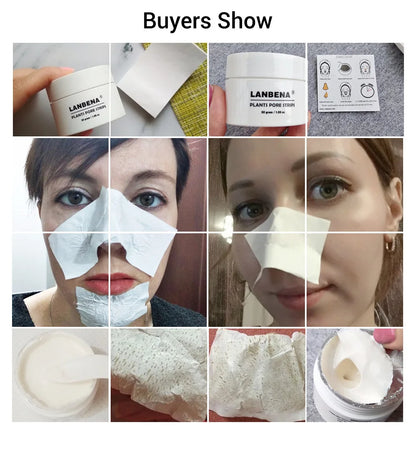 Blackhead nose mask with 60 sheets of popular skin care products - www.kubikstore.com