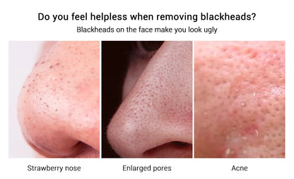 Blackhead nose mask with 60 sheets of popular skin care products - www.kubikstore.com